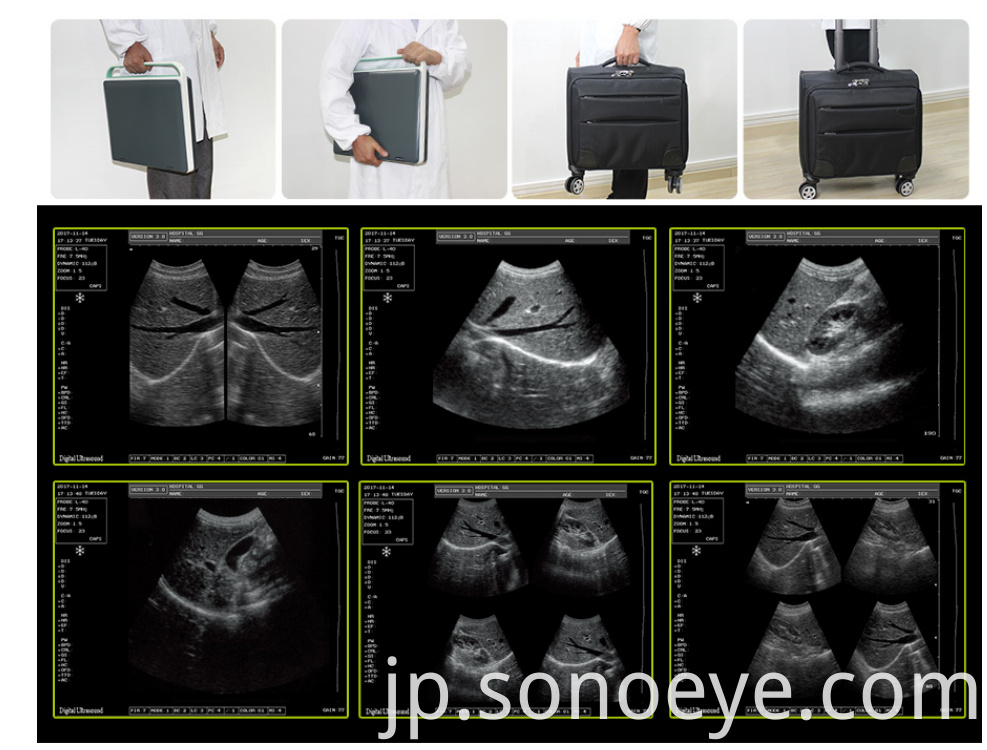 Portable Ultrasound Labtop Type